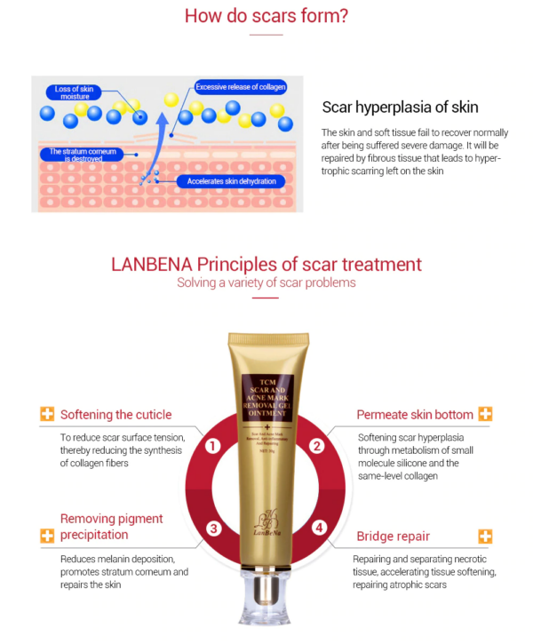 lanbena scar gel features