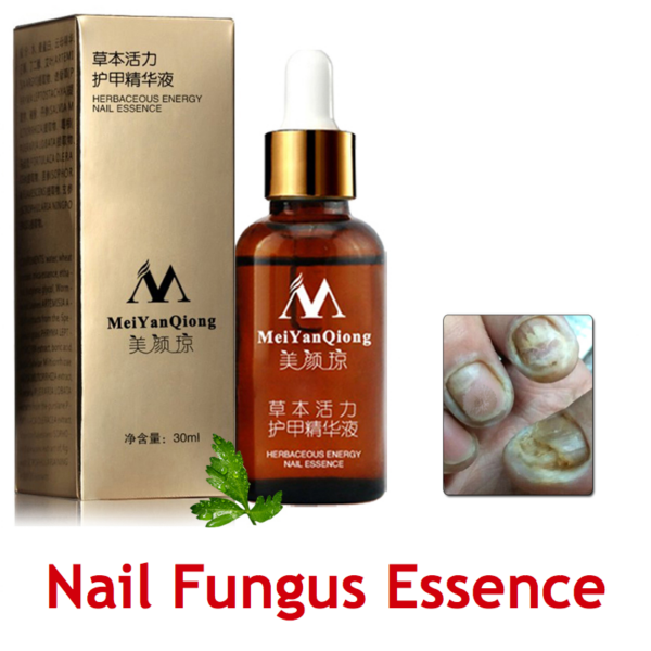 meiyanqiong nail fungus essence