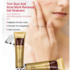 scar gel for scars and acne treatment