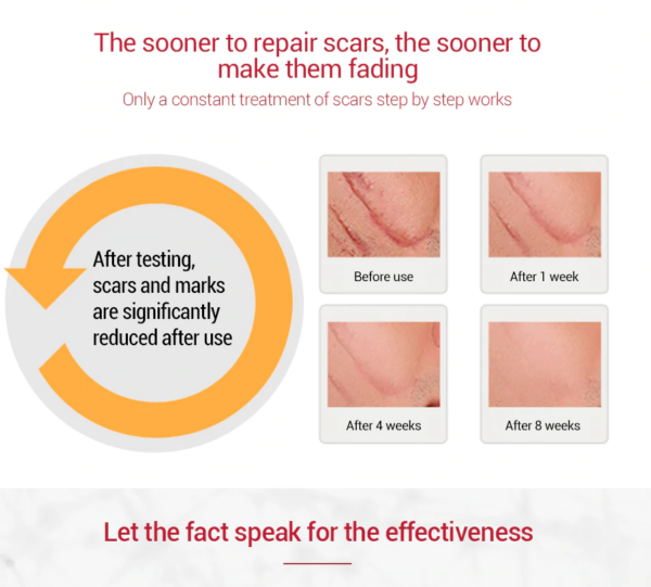 scar gel for scars and acne treatment