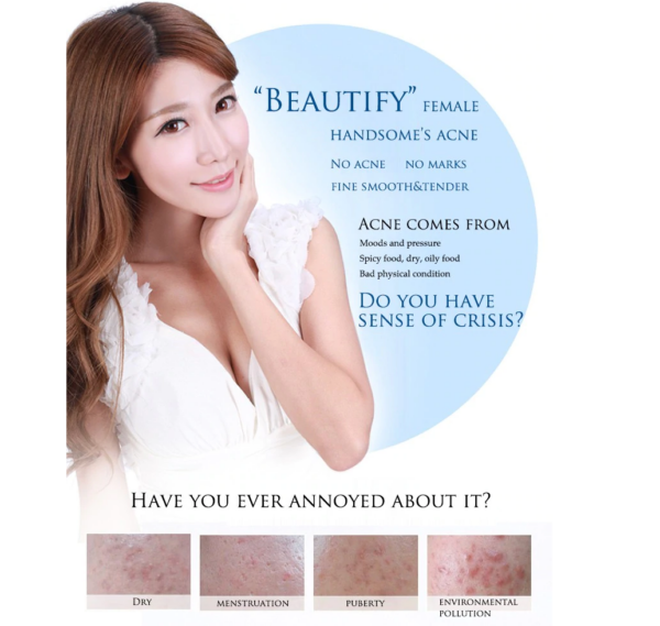 bioaqua acne cream