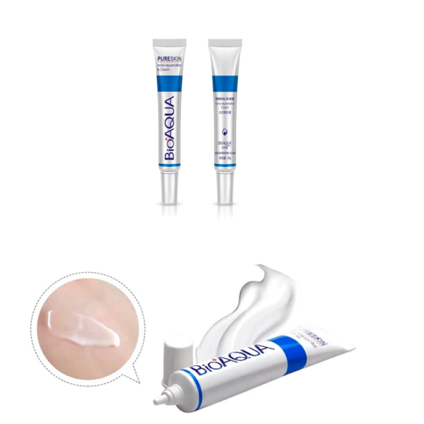 bioaqua cream for acne and pimples