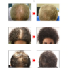 lanbena hair growth serum