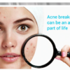 baimiss acne cure treatment cream