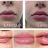 lanbena lips care serum