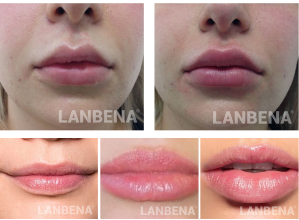 lanbena lips care serum