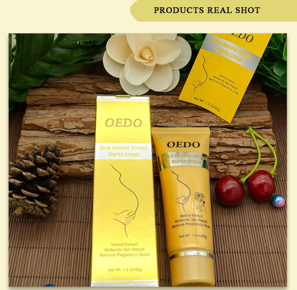 OEDO Pregnancy Stretch Mark Removal Cream