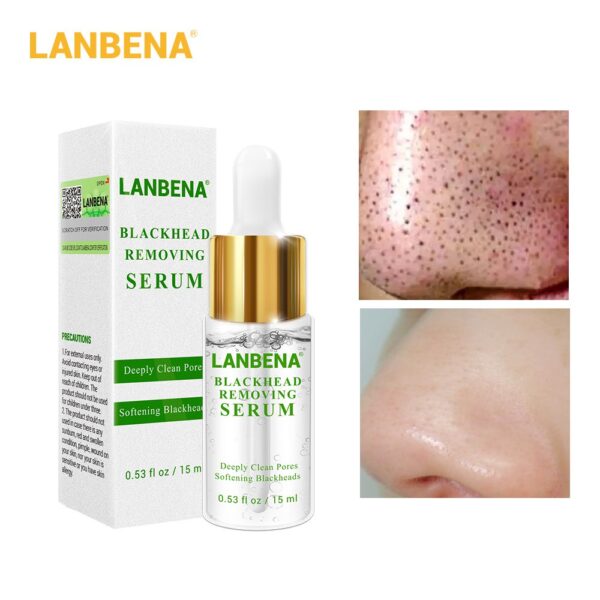 Lanbena blackhead softner