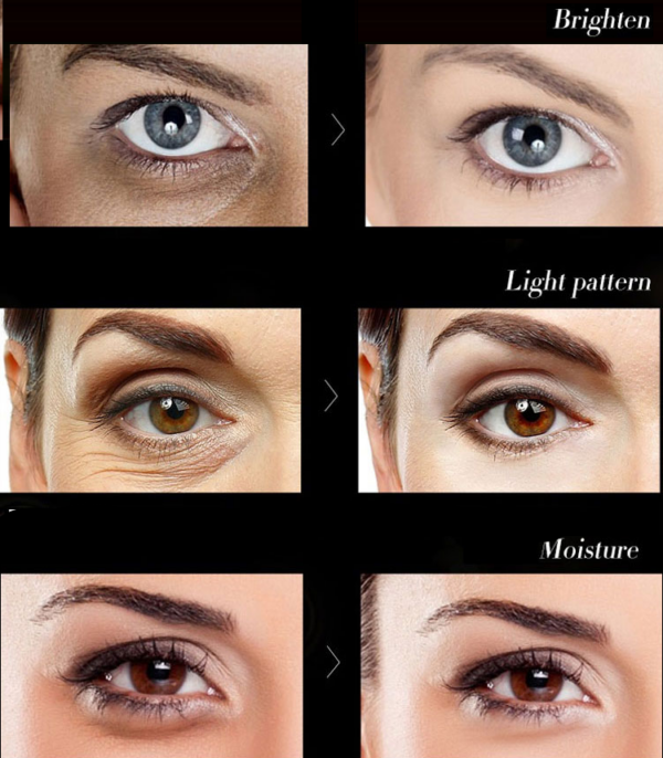 dr rashel eye serum results