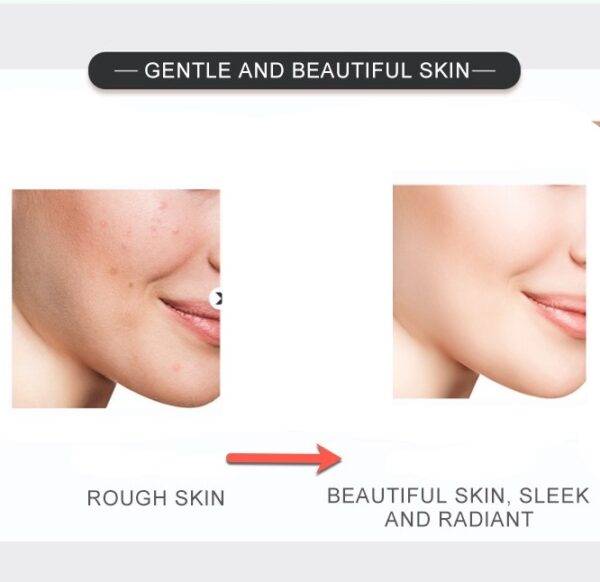 effect of dr rashel serum