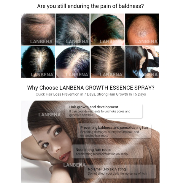 Lanbena hair regrowth spray results