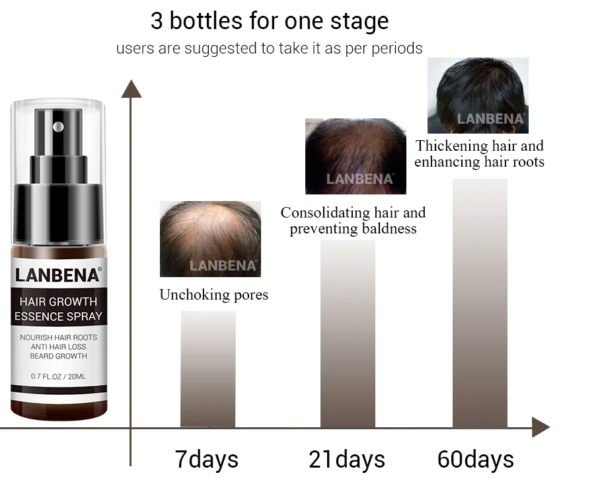 Lanbena hair regrowth spray uses