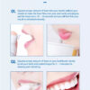 Lanbena Teeth Whitening Mousse Effects