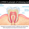 LA PERCA principle of whitening teeth